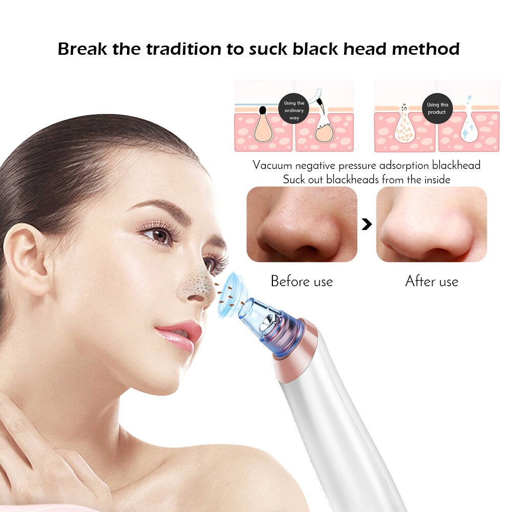 Face Nose Acne Black Dot Pimple Blackhead Remover Electric Blackhead Vacuum Cleaner Pore Blackhead Skin Care Tool Pimple Machine