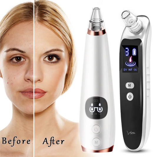 Powerful Blackhead Acne Remover Vacuum Cleaner Black Head Face Skin Care Extractor Pore Nose Lift Suction Facial Removal Massage