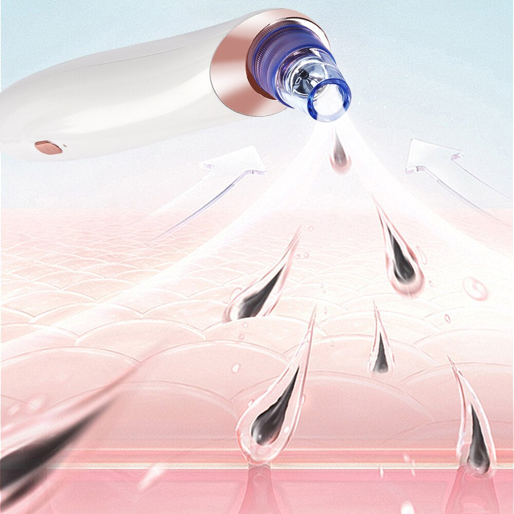 Face Nose Acne Black Dot Pimple Blackhead Remover Electric Blackhead Vacuum Cleaner Pore Blackhead Skin Care Tool Pimple Machine
