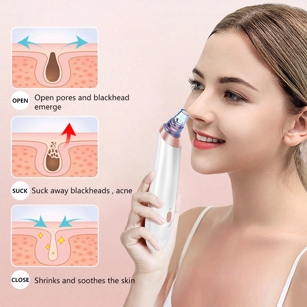 Face Nose Acne Black Dot Pimple Blackhead Remover Electric Blackhead Vacuum Cleaner Pore Blackhead Skin Care Tool Pimple Machine